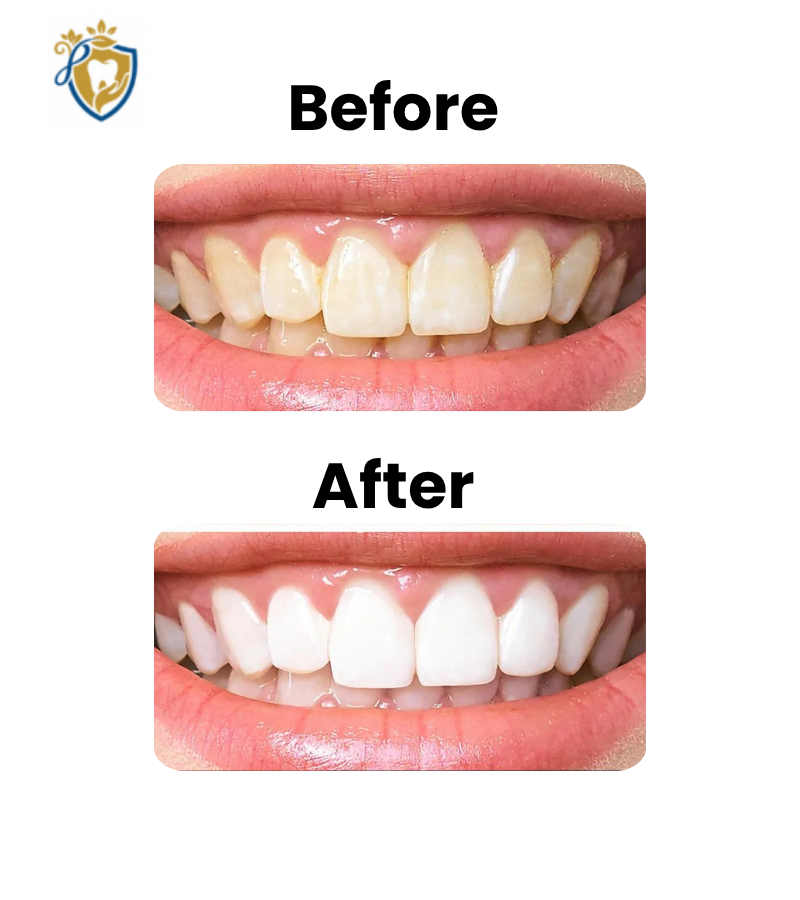 Dental Clinic In Hyderabad