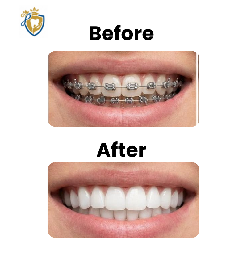 Dental Clinic In Hyderabad