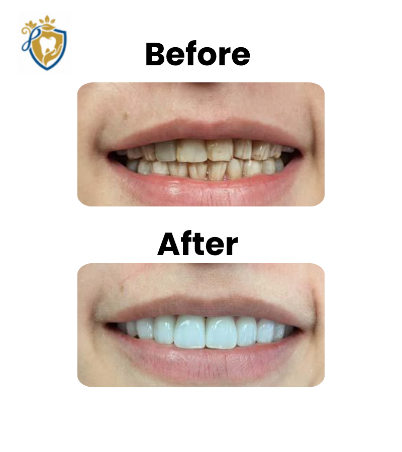 Dental Clinic In Hyderabad