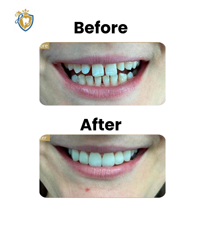 Dental Clinic In Hyderabad